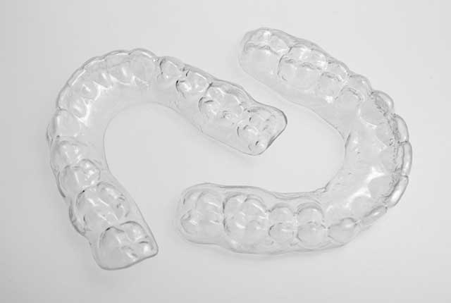 How To Care For Clear Retainers 