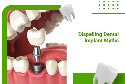 Dental Implants: Our Dental Office in Brampton Separates Fact from Fiction