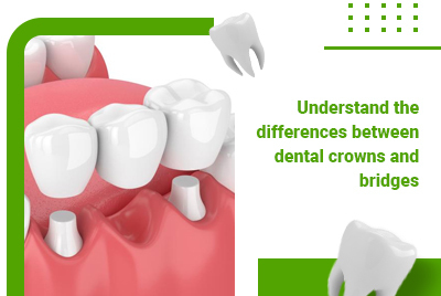Dental Crown & Bridges in Brampton: Understand Their Differences
