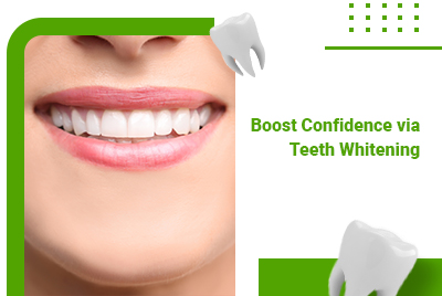 Boost Your Confidence at Our Brampton Dental Clinic via Teeth Whitening