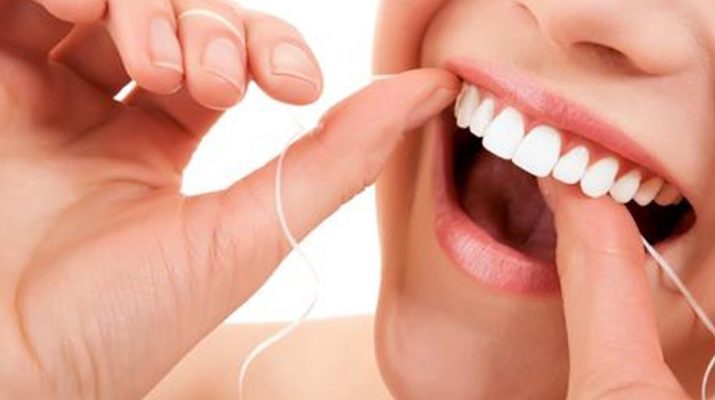 tartar-buildup-on-your-teeth