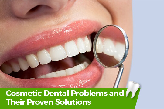 Cosmetic Dental Problems and Solutions
