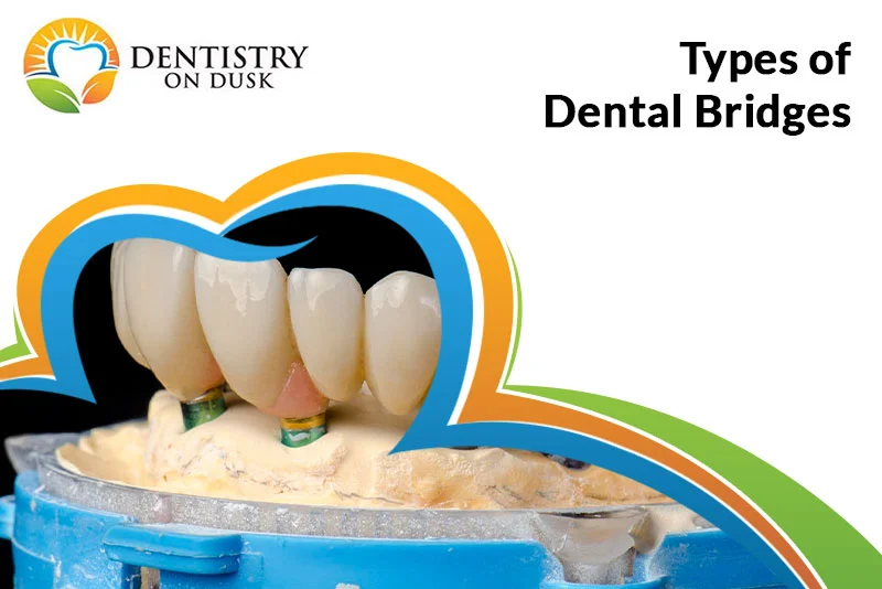 Dentistry Procedure