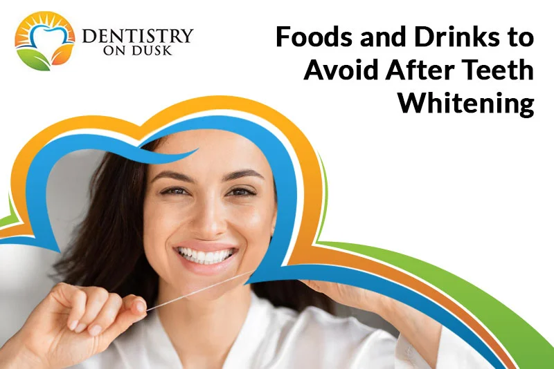 Foods to Avoid After Teeth Whitening