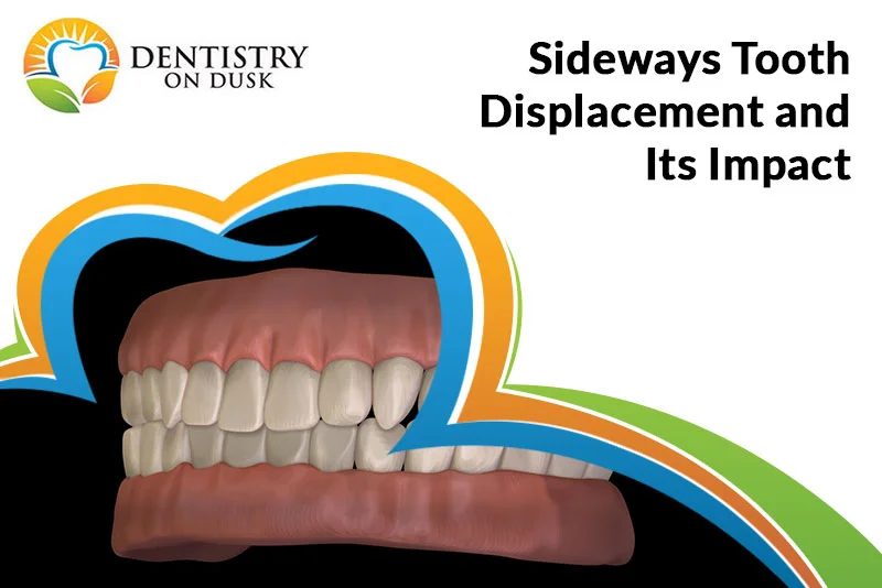 Sideways Tooth Displacement