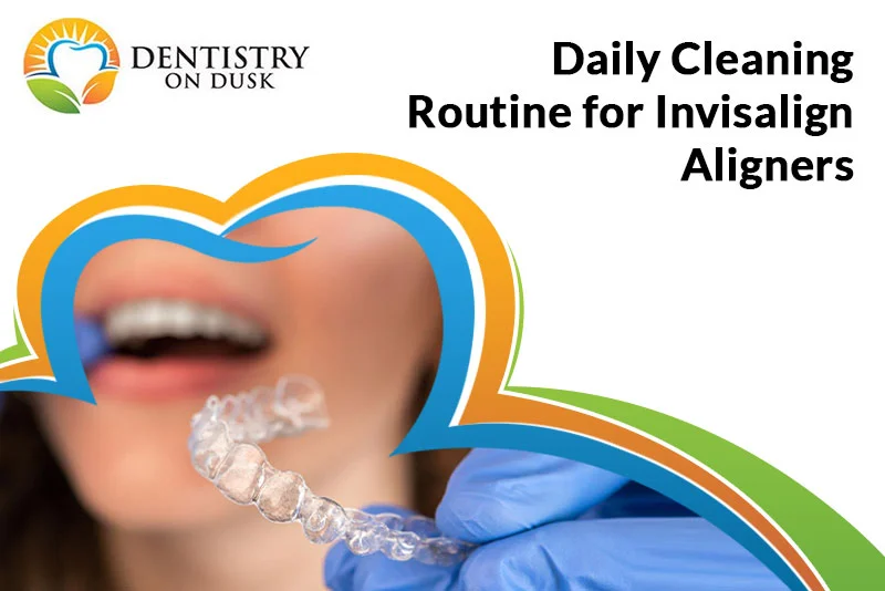 Cleaning Routine for Invisalign Aligners