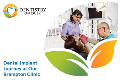 Dental Implants in Brampton 